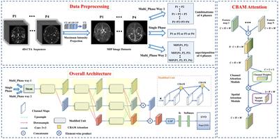 Deep learning-assisted diagnosis of large vessel occlusion in acute ischemic stroke based on four-dimensional computed tomography angiography